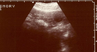 Erstes Ultraschallbild von unserer Bella